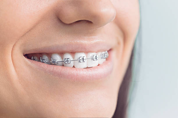 Why Choose Us for Your Dental Needs in Allouez, WI